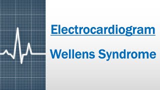 Wellens Syndrome  Diagnostic criteria and Pathophysiology Electrocardiogram [upl. by Armilla498]