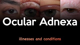 Ocular Adnexa Illnesses and Conditions [upl. by Eimmelc]