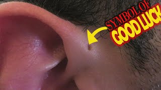 The Meaning of Having a Tiny Hole in the External Ear [upl. by Neoma]