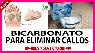 ELIMINAR CALLOS CON BICARBONATO EFICAZMENTE  COMO QUITAR LOS CALLOS DELOS PIES [upl. by Ainigriv]