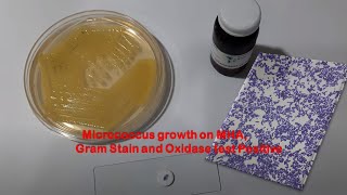 Micrococcus growth on MHA Gram Stain and Oxidase test Positive [upl. by Older921]