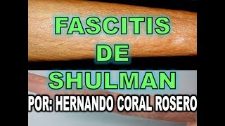 FASCITIS DE SHULMAN Hinchazón y rigidez dolorosa de los miembros [upl. by Auberta254]