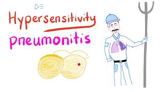 Hypersensitivity Pneumonitis  Restrictive Lung Diseases  Pulmonology [upl. by Emanuel161]