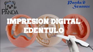 Edentulous Digital Impression with Panda P2 [upl. by Nanine]