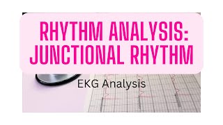 EKG Rhythm Analysis Junctional rhythm [upl. by Tonry]