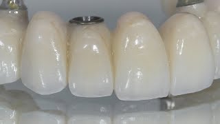 Creating IndividualLooking Teeth On A FullArch Bridge  Dental Lab Learning [upl. by Drucill]