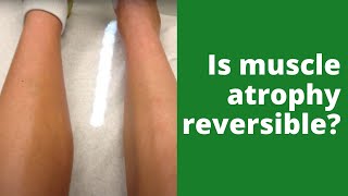 Is muscle atrophy reversible [upl. by Cammie]