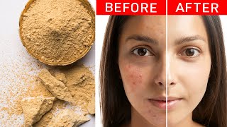 Unlock Natural Beauty with Multani Mitti Treat Acne Tan and Promote Hair Growth 🌿💁‍♀️ [upl. by Solracesoj]