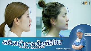 เสริมขมับด้วยซิลิโคน  Temple Augmentation Implant Misti Keosan [upl. by Aisiram488]