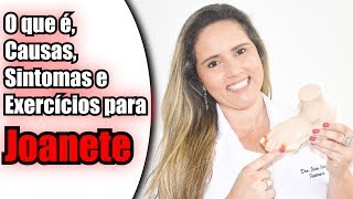 Joanete  Saiba o que é As Causas Os Sintomas e Os Tratamentos [upl. by Clevie305]