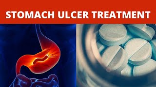 Stomach Ulcer Home Treatment  Licorice Root [upl. by Eisus]