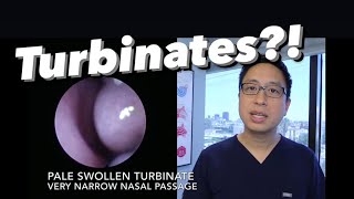 Inferior Turbinates what are they why do they swell stuffy nose congestion how do we treat [upl. by Anma]