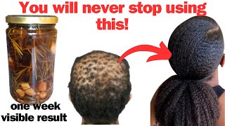 Your Hair May Become too Thick to Handle in Just 1 Week of Using this Hair Growth Tea [upl. by Salb]