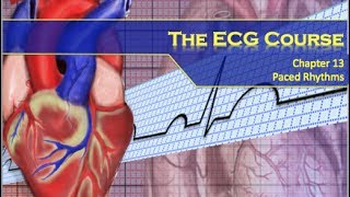 The ECG Course  Paced Rhythms [upl. by Ilak]