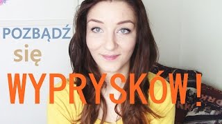 Jak pozbyć się wyprysków w 3 dni kajmanowa [upl. by Hemphill]