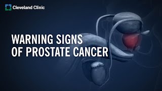 10 Warning Signs of Prostate Cancer [upl. by Aneles]