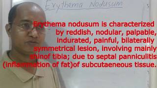 Erythema nodosum  panniculitis Definition Cause Pathology Clinical featureTreatment [upl. by Zelle]