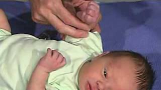 physical exam Newborn Normal Tone  Hand Position [upl. by Dearman990]