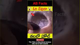 😲తలలో హోల్😲 hole in a mans head telugufacts facts factsintelugu shorts youtubeshorts abfacts [upl. by Oliric16]