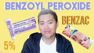 Benzac Benzoyl Peroxide 5 Review for Acne Philippines [upl. by Reidar633]