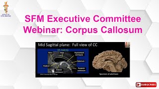 SFM Executive Committee Webinar Corpus Callosum [upl. by Harbison]