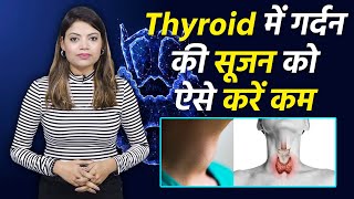 Thyroid Swelling Treatment थाइरॉइड घरेलु इलाज  थायरॉइड में गर्दन की सूजन कैसे ठीक करें  Boldsky [upl. by Corwin931]