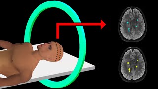 PET Scan  How It Works  Animation [upl. by Louls]