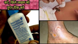 Neosporin power uses in hindi पसीने की खुजलीइन्फेक्शन [upl. by Greabe]