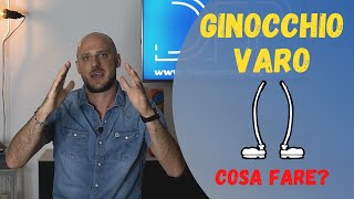 Ginocchio varo  Significato  Conseguenze  Soluzioni [upl. by Omixam]