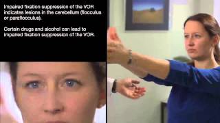 Visual Fixation Suppression of the VOR [upl. by Rai]