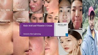 Zeelab Kojic Acid Vitamin C Cream  Honest Review [upl. by Nahtaj923]