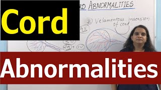 Umbilical Cord Abnormalities 🚺 Morphological variation of Cord 🚺 Nursing Lecture [upl. by Alisun]