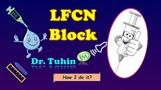 Lateral Femoral Cutaneous Nerve Block  Ultrasound  Loss of Resistance  LFCN Block [upl. by Llebanna]