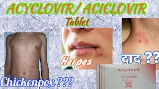 Acyclovir tablets  Herpikind  Herpikind Tablet  Zovirax  Zovirax tablets  uses side effects [upl. by Goldshlag655]