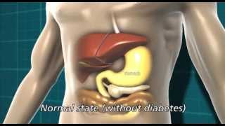 Diabetes and the body  Diabetes UK [upl. by Grant695]