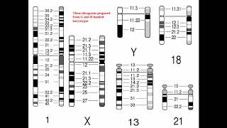 Cytogenetics II Chromosome Analysis amp Karyotypes [upl. by Hanala610]