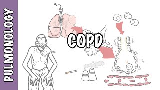 Understanding COPD  Chronic obstructive pulmonary disease cause pathophysiology and treatment [upl. by Litnahs]