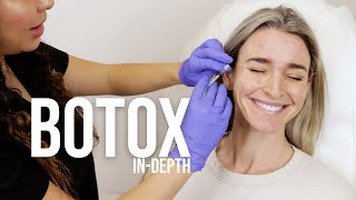 BOTOX  INDEPTH [upl. by Mossman]