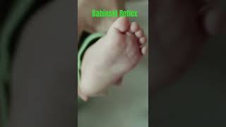 quotNewborn Babys Babinski Reflex Fascinating Developmental MilestonequotNewbornBabinskiReflex newborn [upl. by Velma]