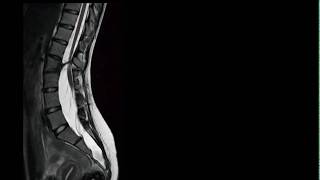 Radiology Teaching point 34 DrAmr Saadawy [upl. by Attenna]