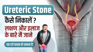 Ureteric Stone in Hindi  Symptoms ManagementTreatment Pain xrays  Ureteric Stone kaise nikale [upl. by Riobard]