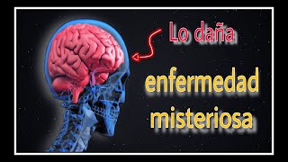 ¿Qué es la ESCLEROSIS MÚLTIPLE Y por que es una enfermedad que no tiene cura [upl. by Erialc]