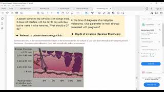 Plab 1 Lecturers Dermatology Part 13 Skin CancersDermal Melanosis XanthlaesmaLipomaParonachya [upl. by Leivad]