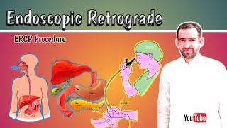 Endoscopic Retrograde Cholangiopancreato GraphyERCP Procedure explained [upl. by Analeh906]