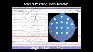 Introduction to EEG [upl. by Felicity]