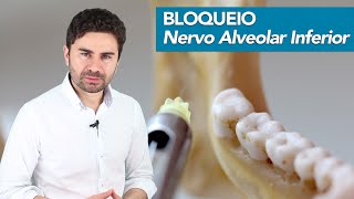 PassoaPasso do Bloqueio do Nervo Alveolar Inferior  Prof Fernando Giovanella [upl. by Jaf]