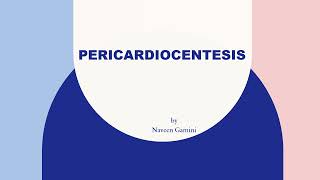 PERICARDIOCENTESIS [upl. by Dede]