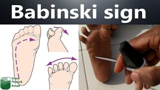 Babinski SignReflexPlantar ReflexGreen Physio amp Rehab [upl. by Yenaiv]