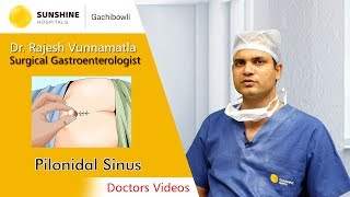 Pilonidal Sinus  Dr Rajesh Vunnamatla  Advanced Laparoscopic Surgeon [upl. by Eberhart]