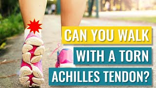 Can You Walk on a Torn Achilles Tendon Partial  Full Ruptures [upl. by Schoenberg300]